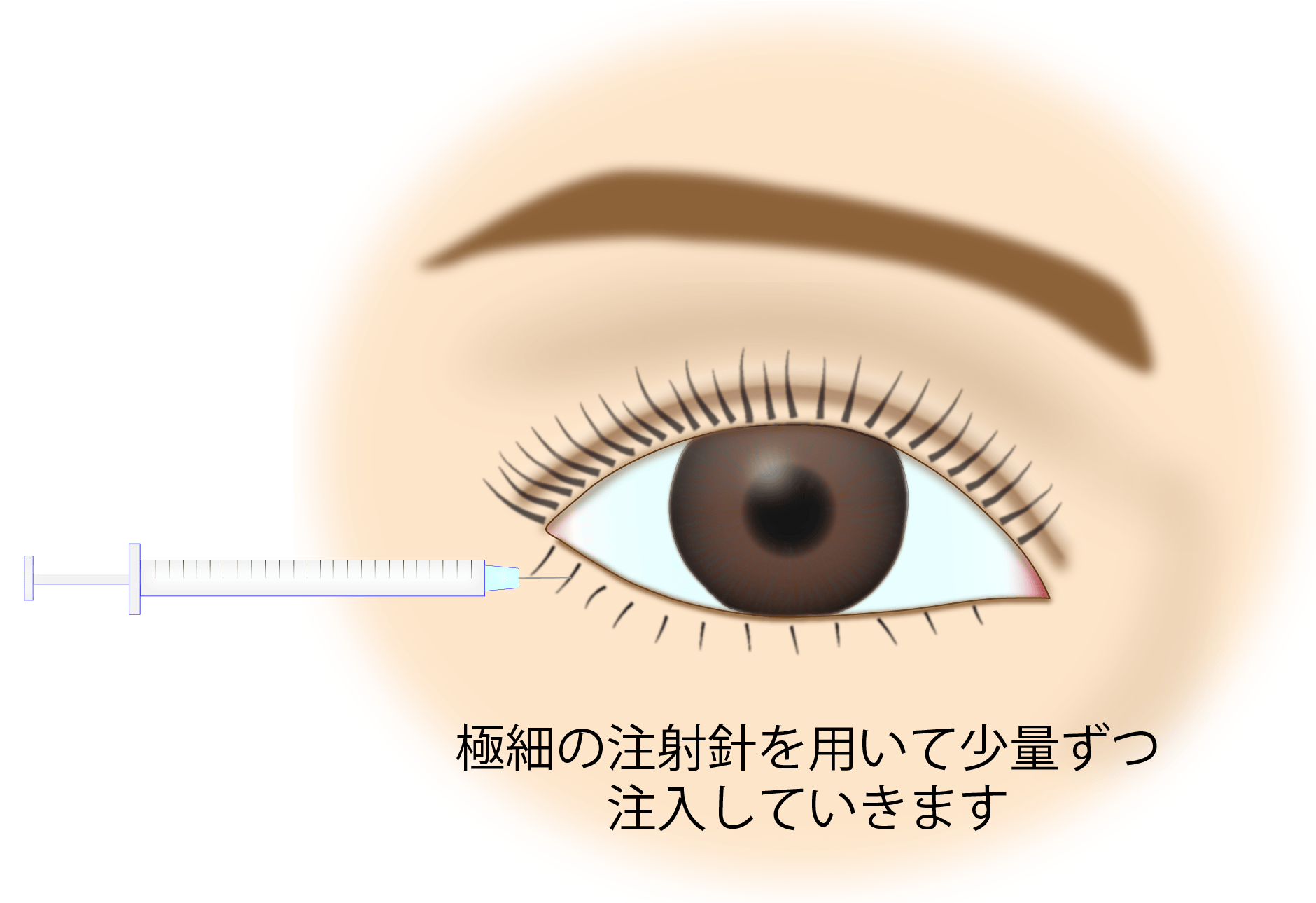 涙袋